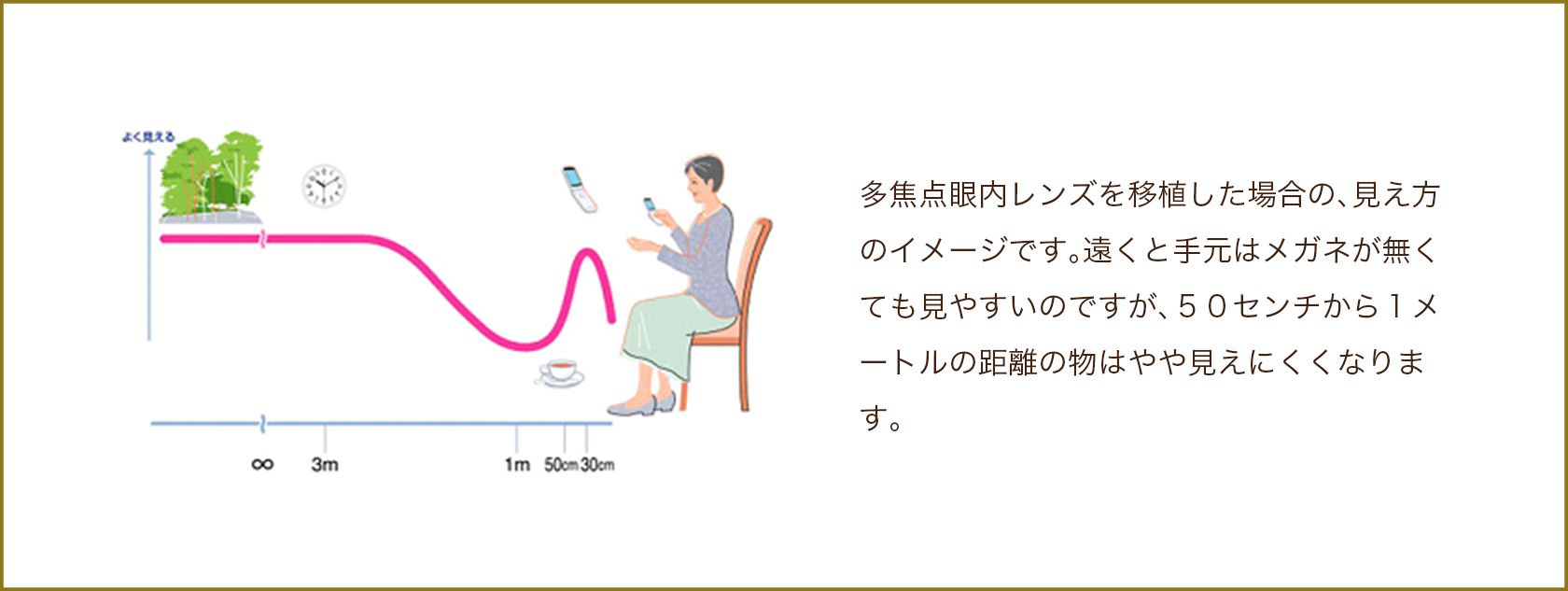 多焦点眼内レンズの焦点の合いやすい距離