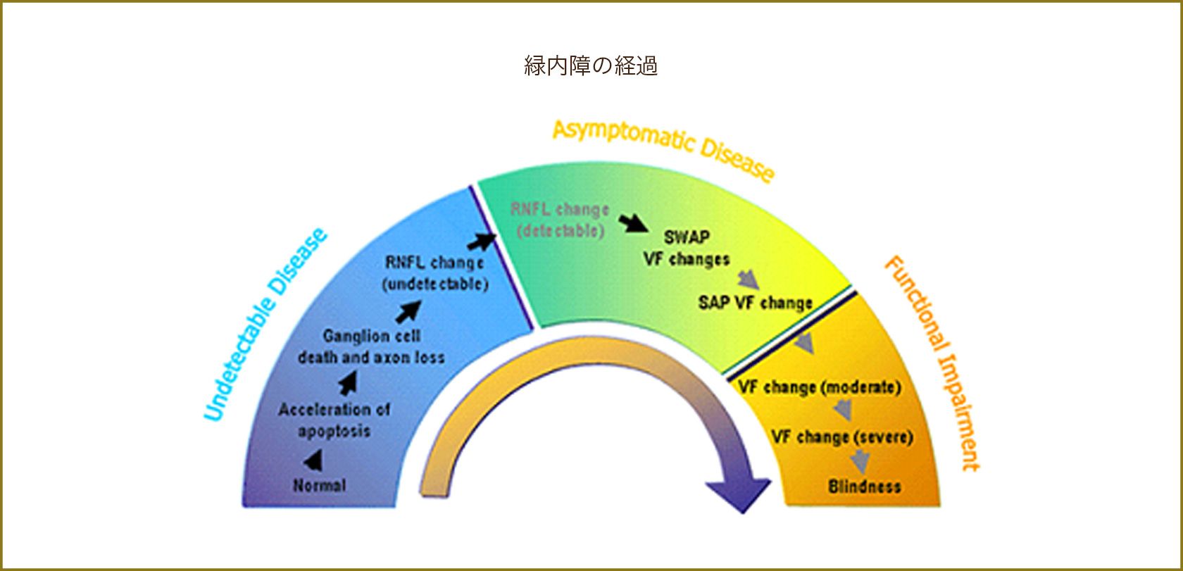 緑内障の経過