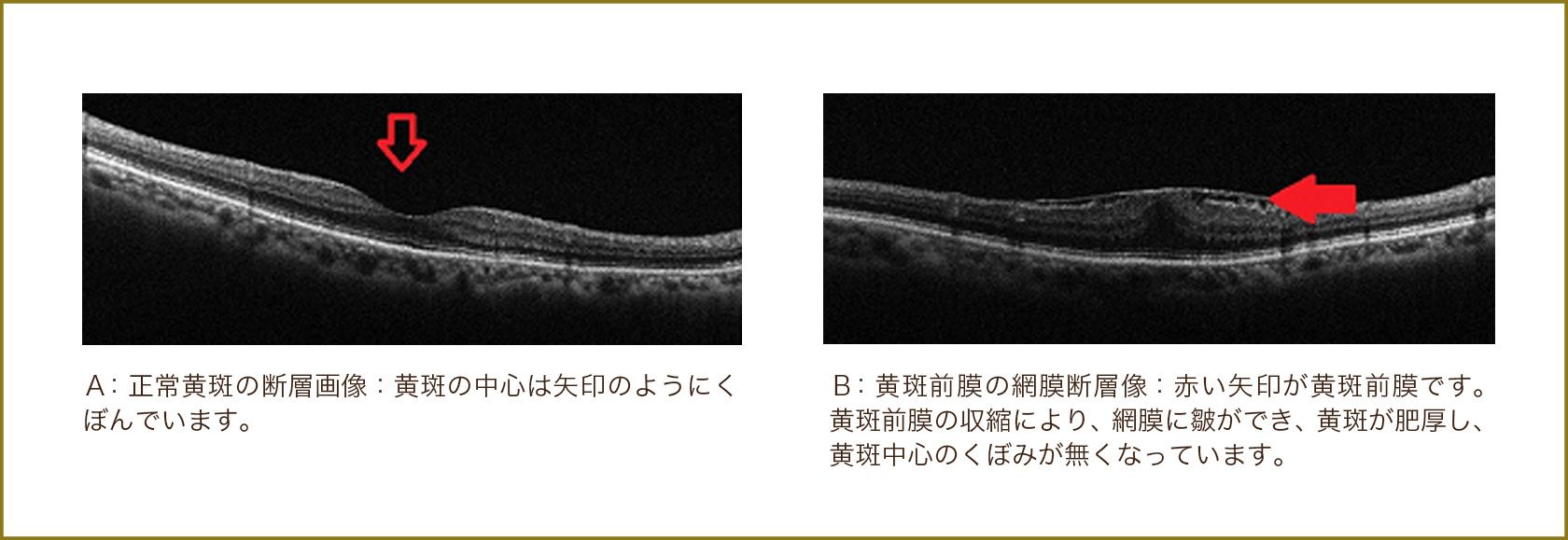 調節について