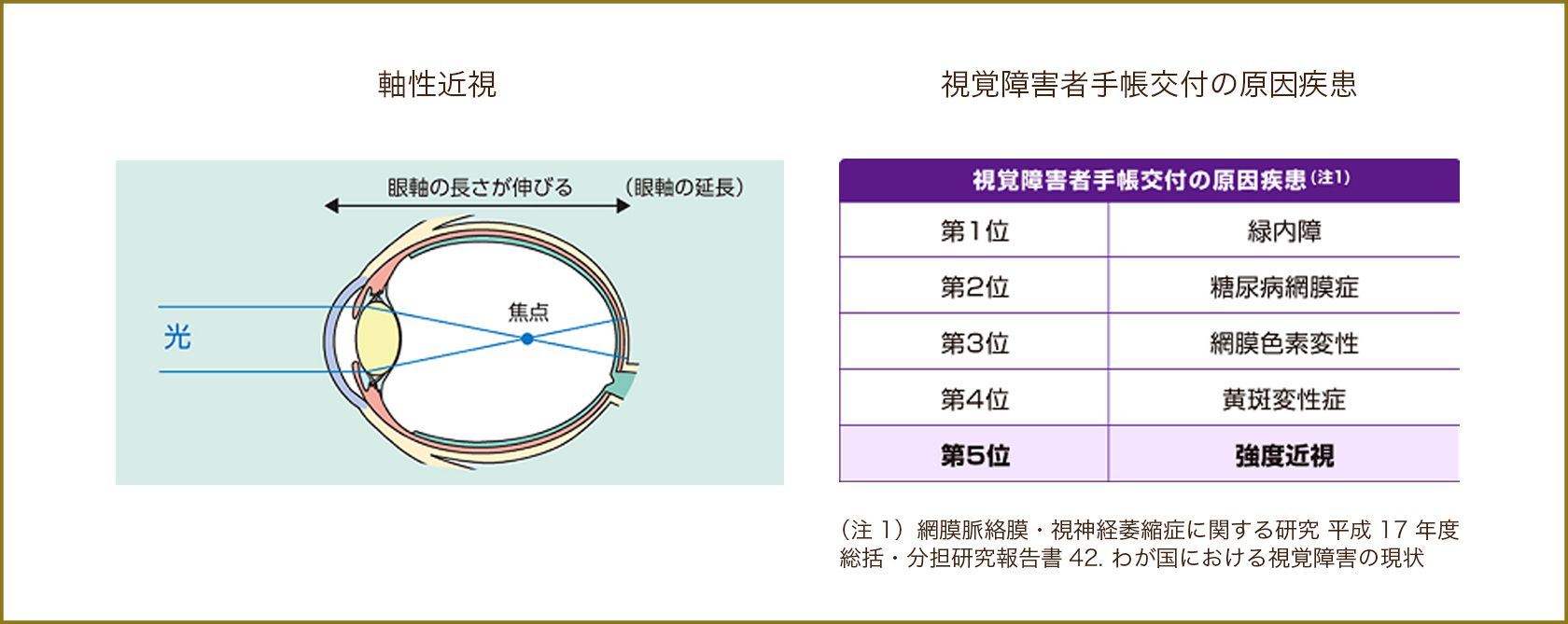 軸性近視,視覚障害者手帳交付の原因疾患