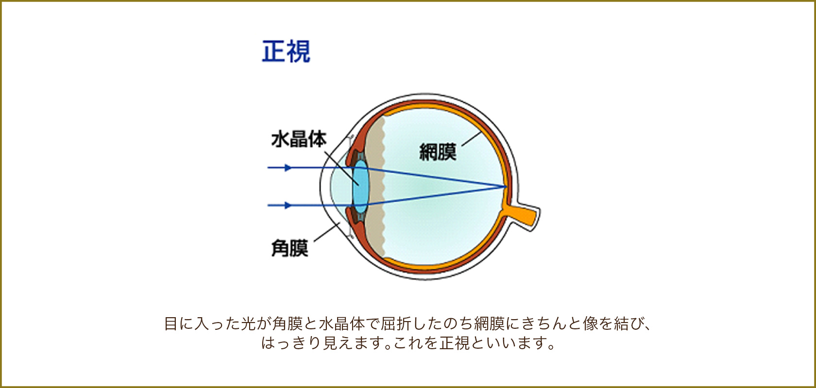 光 を 屈折 する 眼 の 構造 は どれ か