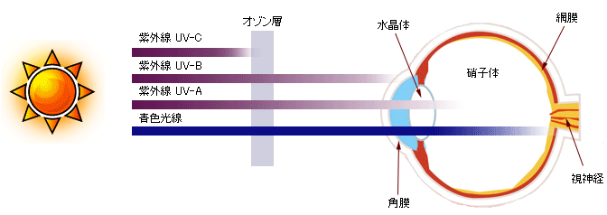 その他の眼がんの症状